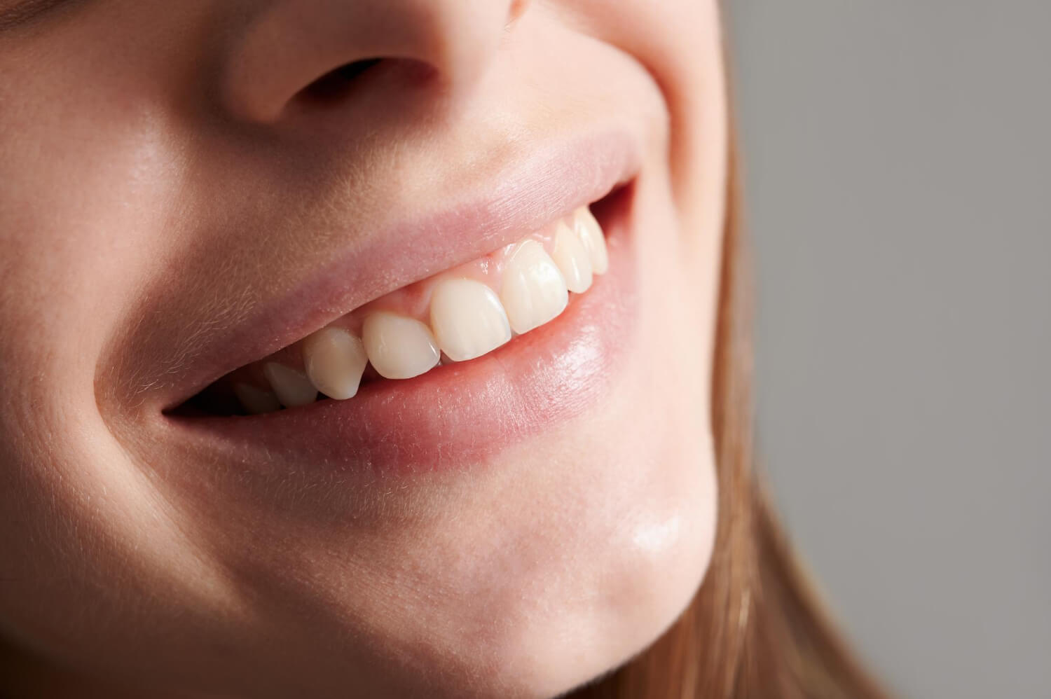 Tratamento de Gengiva dentista aricanduva