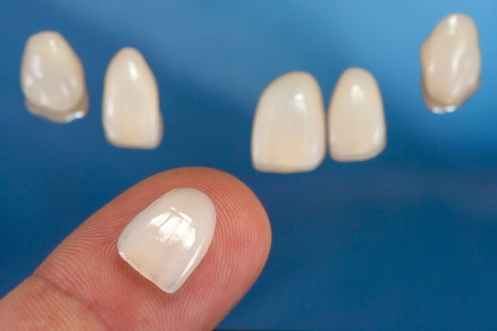 Lentes de Contato Dental dentista aricanduva