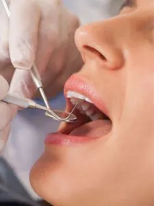 O Que Acontece Se Eu Não Tratar um Canal Necessário